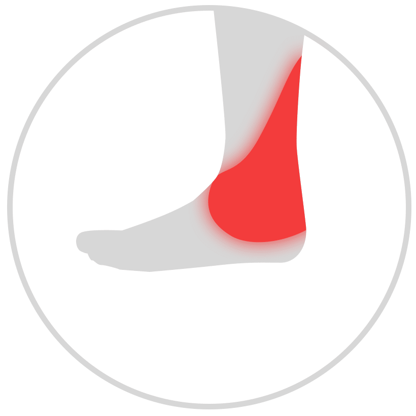 Illustration of ankle pain